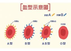 研究發(fā)現(xiàn)血型與疾病的發(fā)生有相關(guān)性